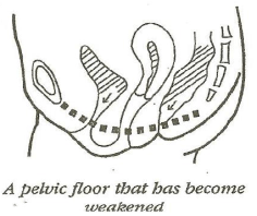 Picture, Pelvic Floor Muscle