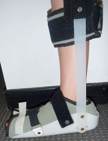 Figure 8: A rigid night splint to keep the foot at 90 degree angle.