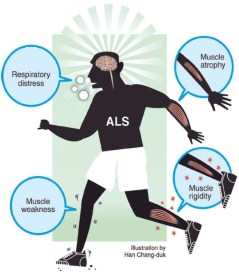 ALS, Amyotrpohic Lateral Sclerosis, Motor Neurone Disease